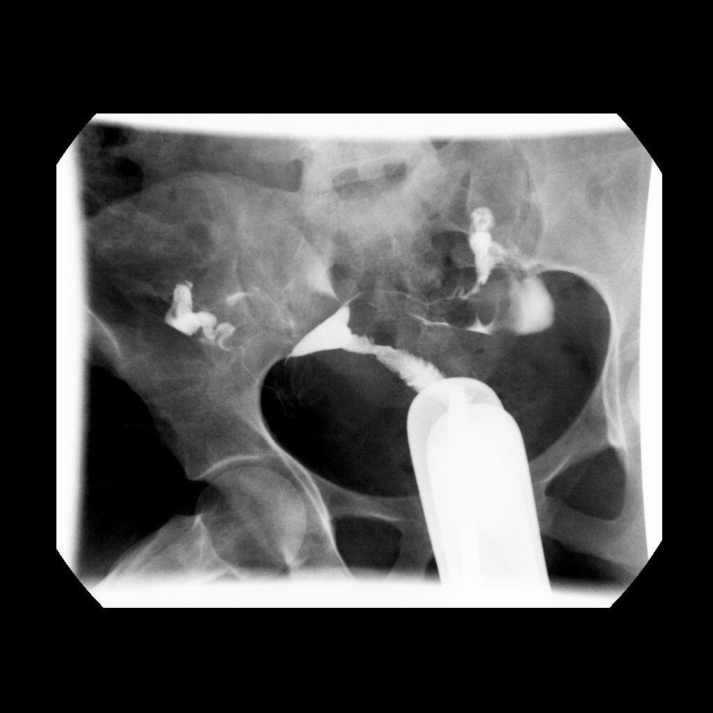 WhatsApp Image 2022-03-17 at 3.07.19 PM Cardiologist,Use,Tubes,And,Ultrasound,For,Radiofrequency,Catheter,Ablation.