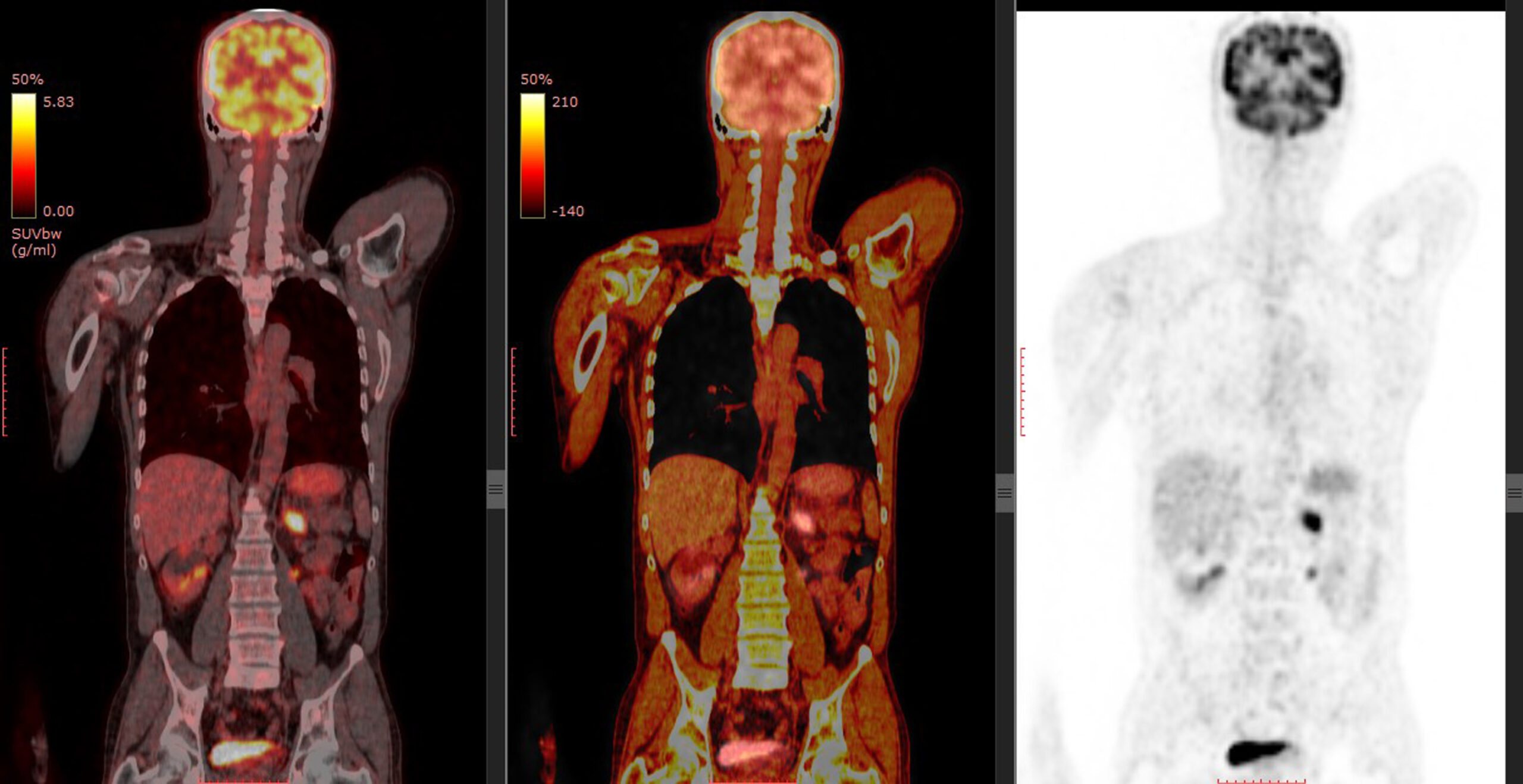 Cardiologist,Use,Tubes,And,Ultrasound,For,Radiofrequency,Catheter,Ablation.